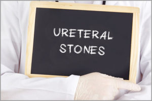 What Are Kidney, Bladder, and Ureteral Stones?